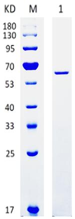 15% SDS-PAGE analysis profiles of purified VP3 (CBB stained).
